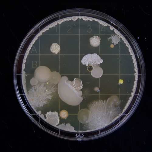 Bacteriën ontwikkelen nieuwe manieren om antibiotica te weerstaan